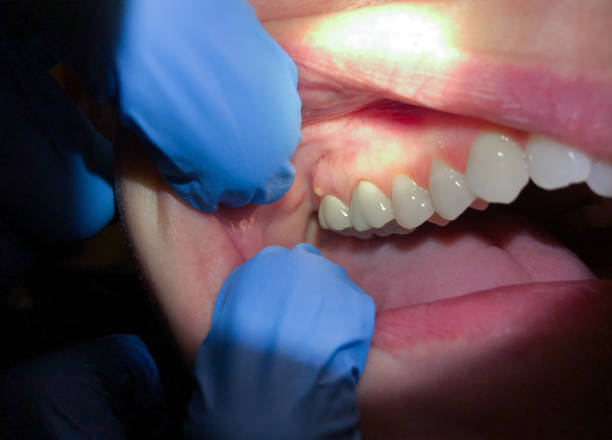 Best Weekend Emergency Dentist in Brentwood, MO